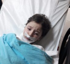 Kocaeli'de köpeklerin saldırısına uğrayan 5 yaşındaki çocuk yaralandı
