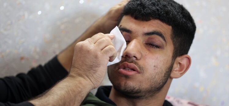 İsrail'in attığı ses bombası nedeniyle görme yetisini kaybeden Filistinli çocuk “hayallerine” tutunuyor